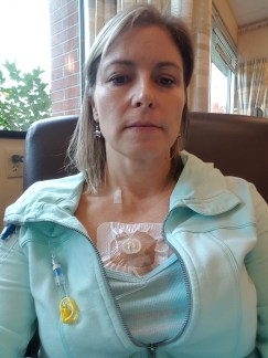 First Chemotherapy